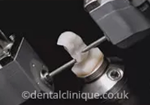 cerec denistry