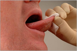 Mouth Cancer Screening